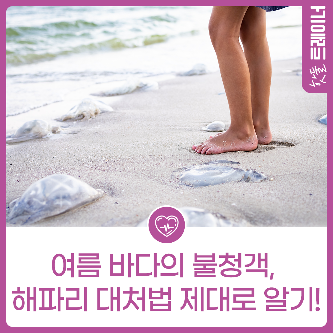 여름 바다의 불청객, 해파리 대처법 제대로 알기!이미지